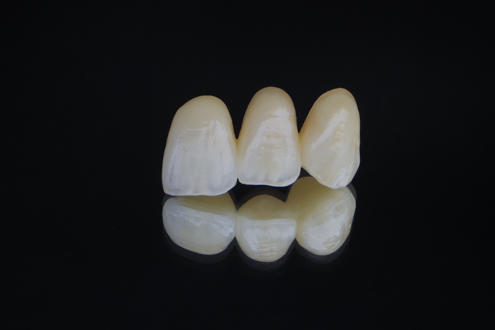 オールセラミックス（イージーオーダー）